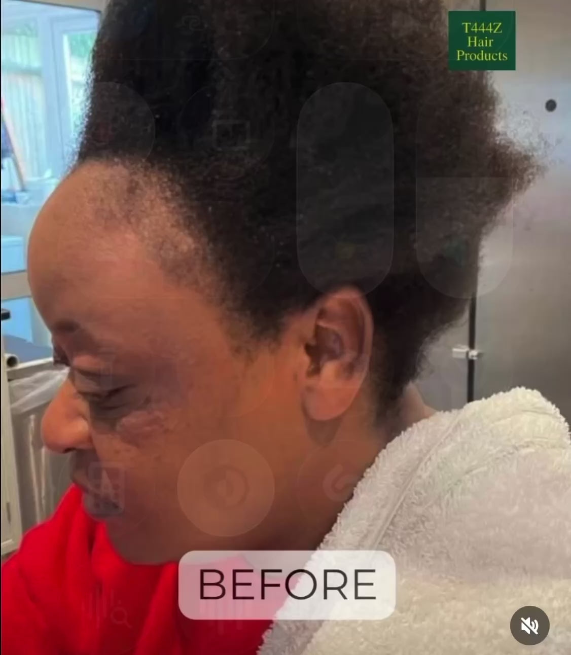 T444Z Starter Kit — Hair Growth Bundle | NaturesNaturalHair