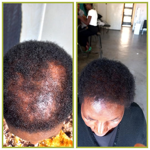 Before and after comparison of a person's hair growth in an indoor setting.