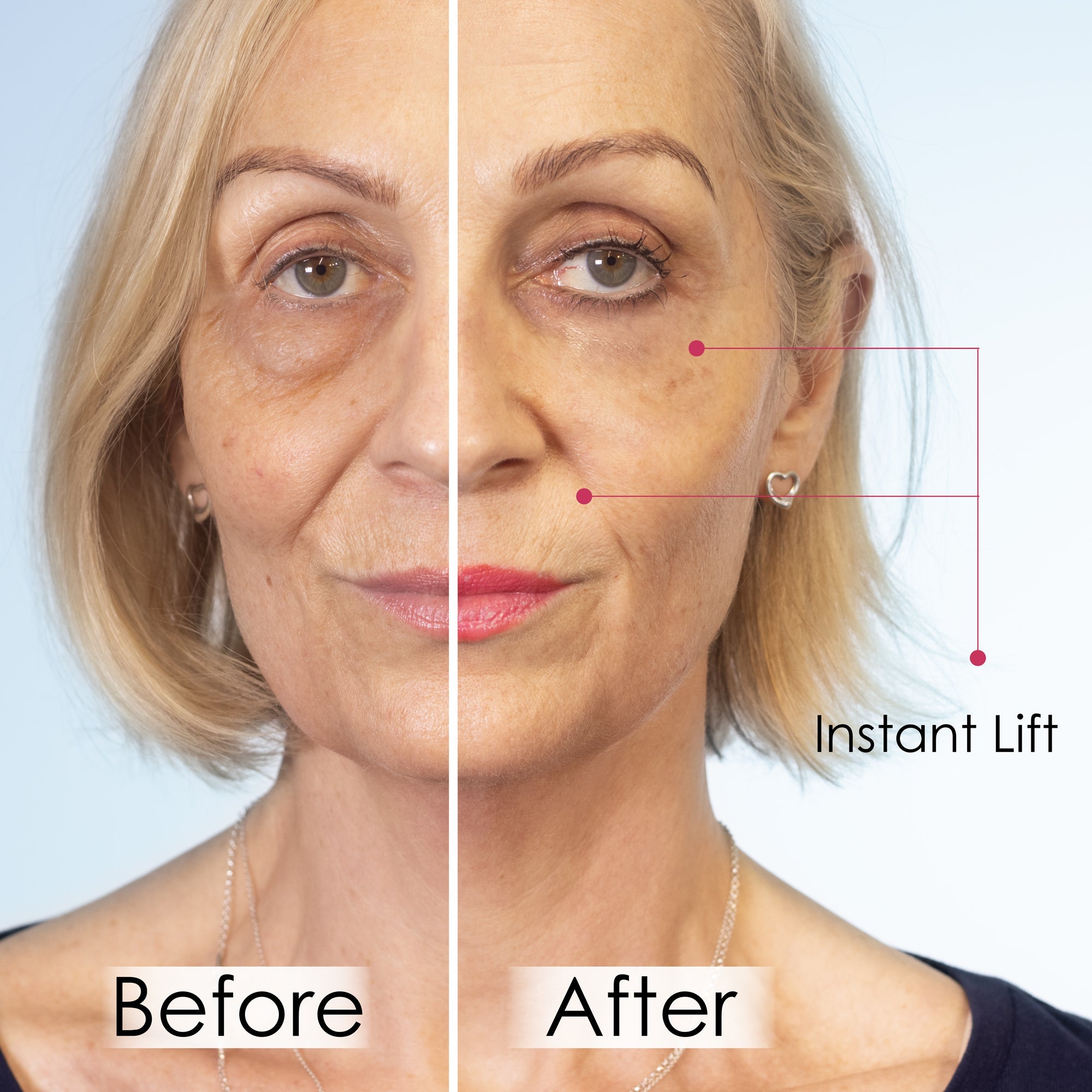 Before and after comparison of a woman's face with 'Instant Lift' effect.
